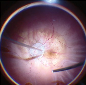FusionOpticsںϹW(xu)g(sh)